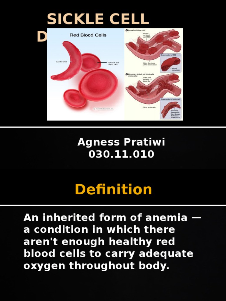 Sickle Cell Disease Overview | PDF