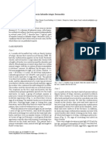 Annular Erythema and Papules in Infantile Atopic Dermatitis: Short Communication
