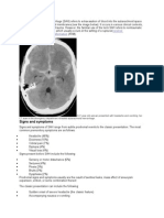 Cerebral Aneurysm Arteriovenous Malformation: Signs and Symptoms