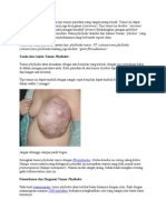 98650479 Piloides Tumor 2