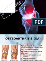 Penyuluhan Osteoartritis