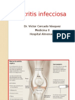 Artritis Infecciosa