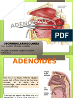 Adenoid It Is