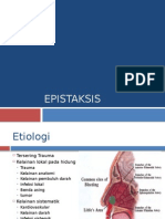 epistaksis