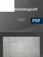 Cardiotokografi Gari