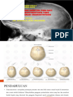 Craniosynotosis PP