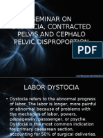 Dystocia