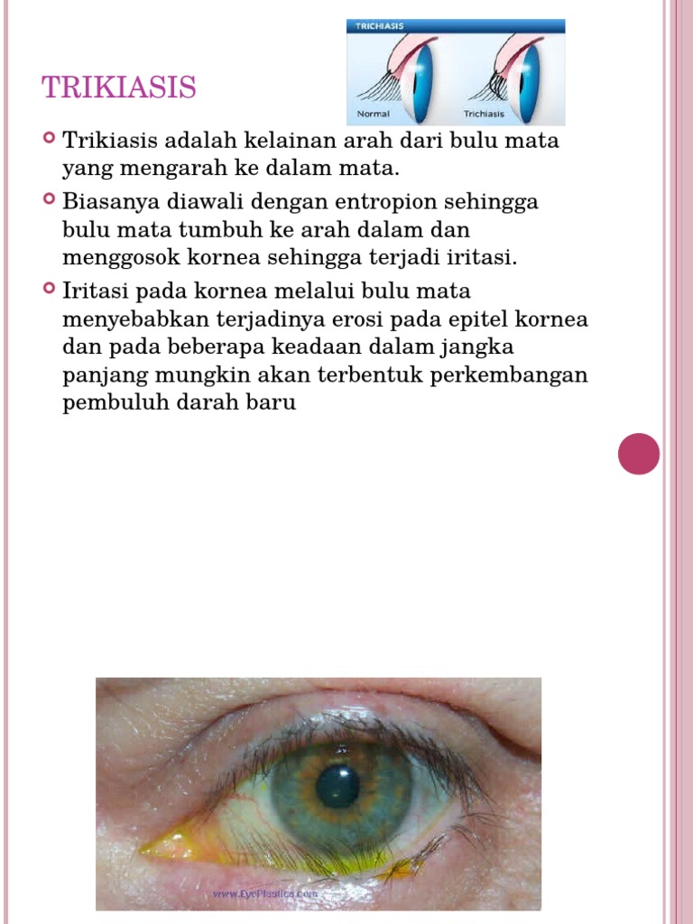 Trikiasis | PDF