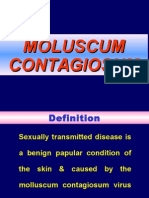 Moluscum Contagiosum Diana