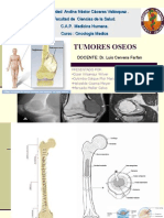 Tumores óseos: clasificación, localización y síntomas