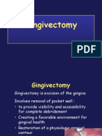 Gingivectomy