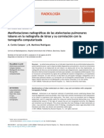 Manifestaciones radiográficas de las atelectasias pulmonares