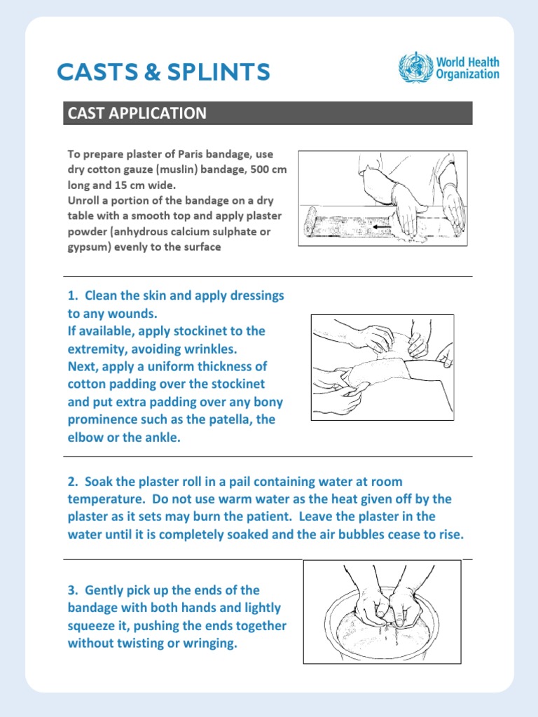 Casts & Splints Who | Plaster | Nature