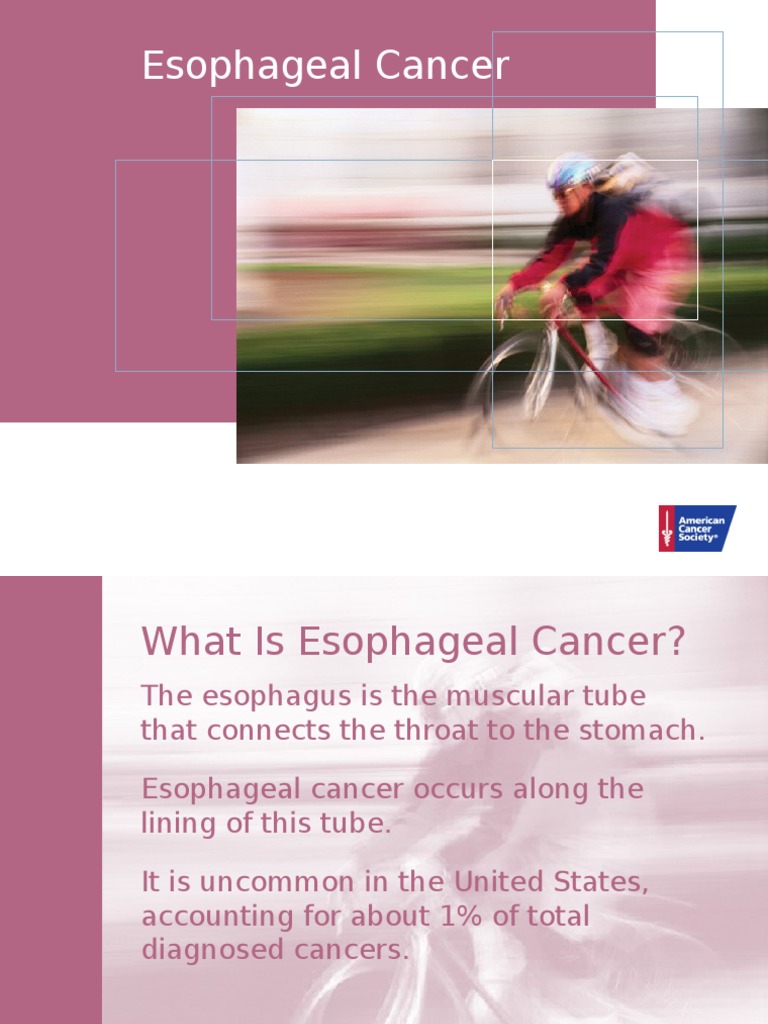 Esophageal Cancer 2015 | PDF | Esophageal Cancer | Esophagus