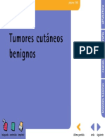 Tummores Benignos