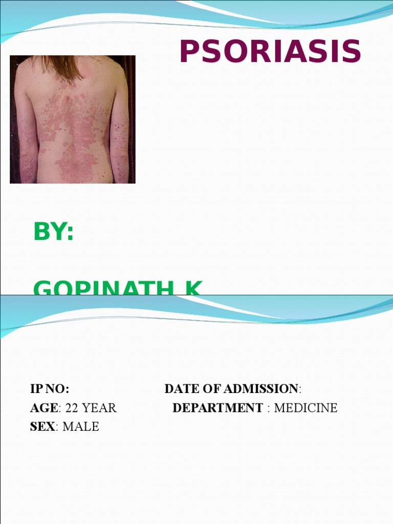 Psoriasis Case Study: Symptoms and Treatment | PDF | Self-Improvement ...