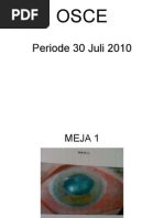 Download Kumpulan Soal OSCE Mata by Hendy Pratamaputra SN275851610 doc pdf