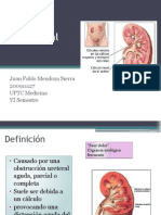 Colico renal