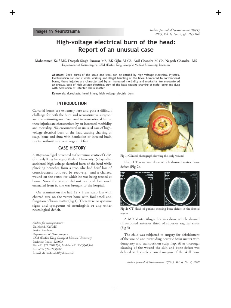 Electrical Accident7 | PDF | Burn | High Voltage
