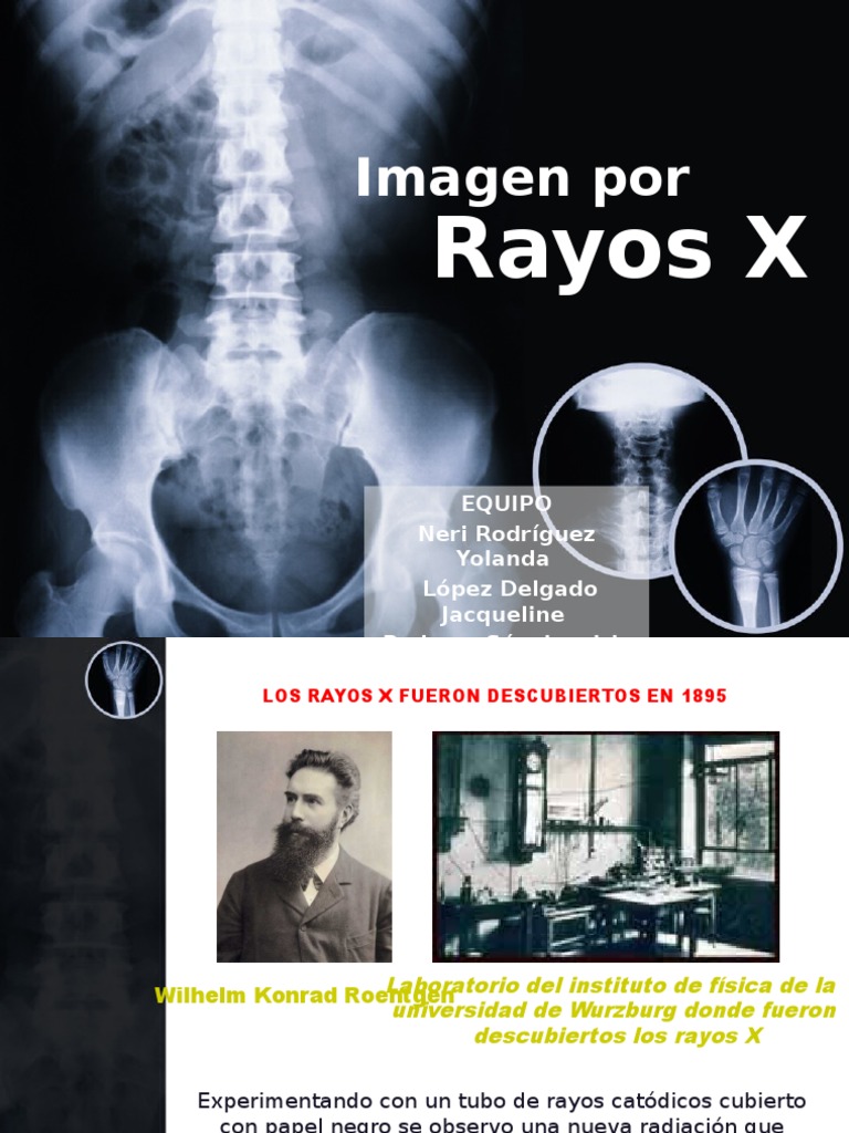Rayos X Presentacion | PDF | Rayo X | Radiografía