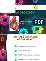 Chest Radiology