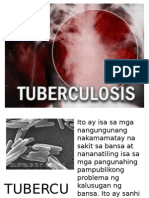Tuberculosis Visual Aid