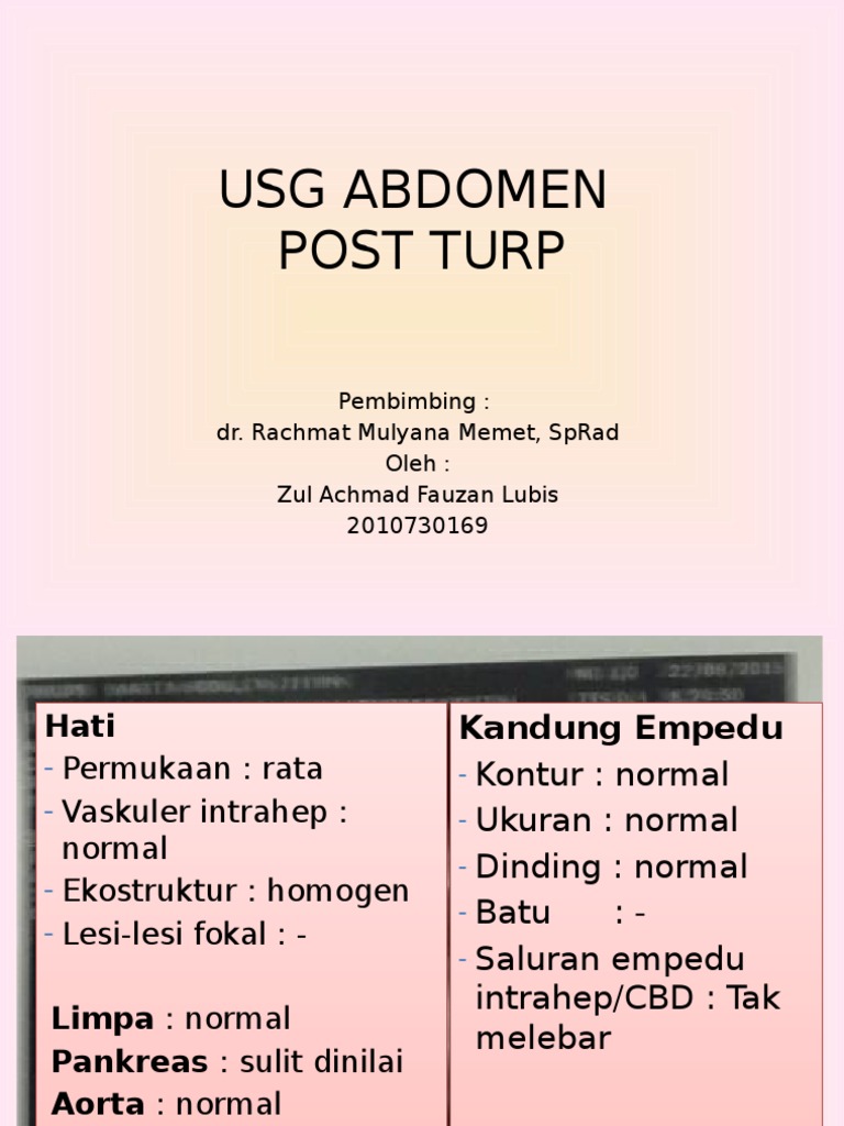Meteorismus dan Ascites Pasca TURP | PDF