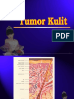 Tumor Kulit