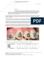Tecnica Biofuncional Ortodoncia