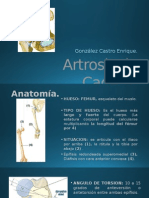 Artrosis de Cadera