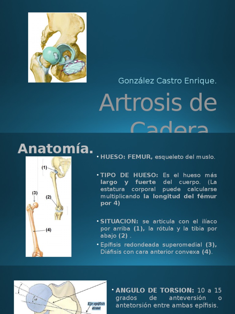artrosis-de-cadera-pdf-cadera-anatom-a-humana
