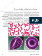 The Eff Ect of Iron Overload On Red Blood Cell Morphology