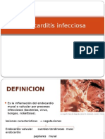 Endocarditis Infecciosa