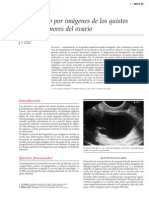 Diagnosticoporimagenquistesdeovario 130926192626 Phpapp02