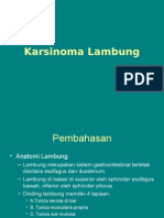 Karsinoma Lambung