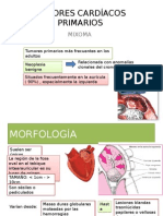 Tumores Cardíacos Primarios