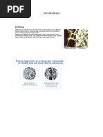 Download Osteoporosis by nunualone SN27771639 doc pdf