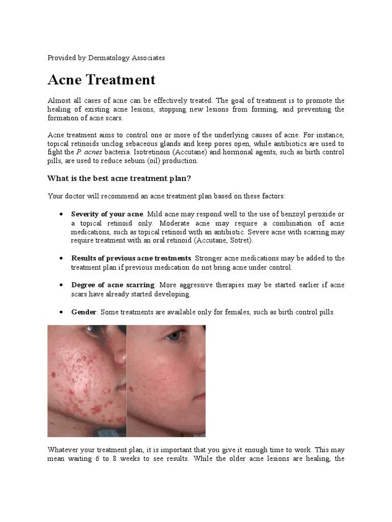 Acne Treatment | Download Free PDF | Pharmacology | Medicine