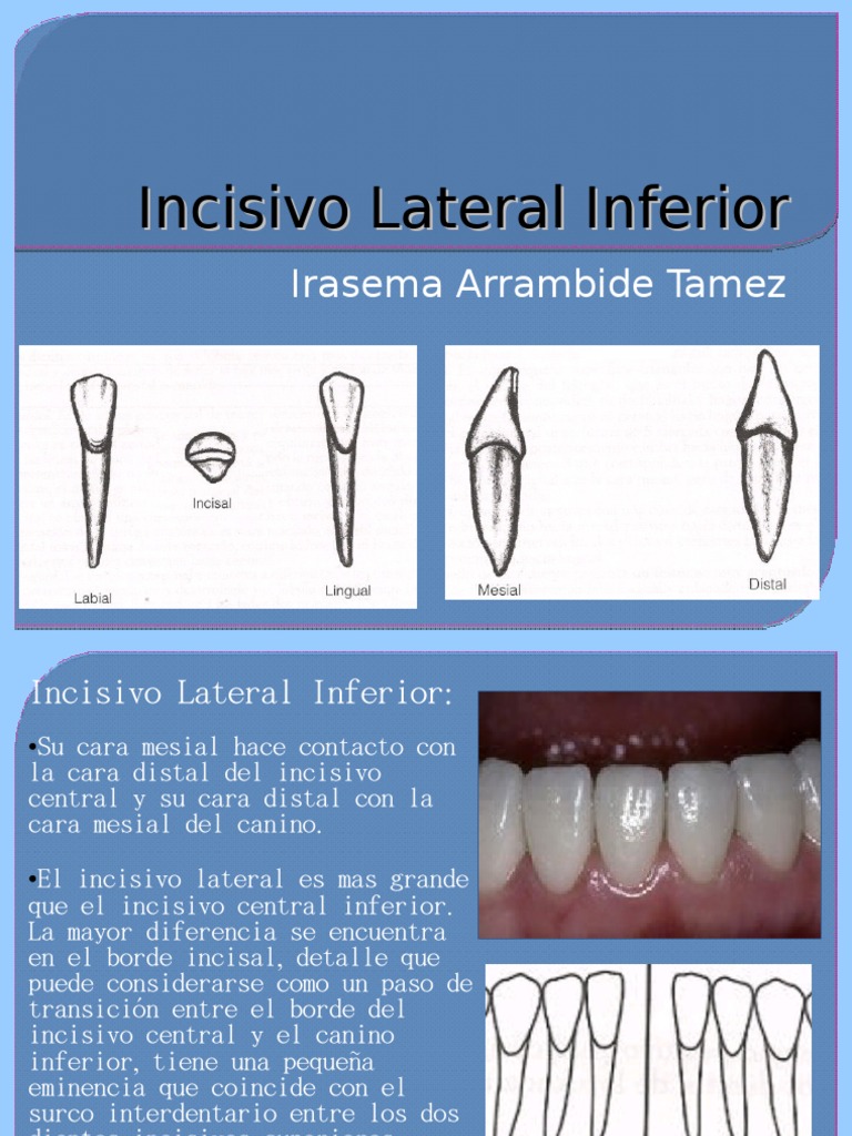 Anatomía del Incisivo Lateral Inferior | PDF | Anatomia dental | Diente