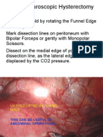 Total Laparoscopic Hysterectomy Part3