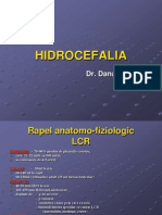 HIDROCEFALIA.pdf