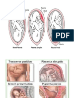 Abnormal Placenta