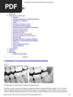 Tratamientos de Ozono Para La Enfermedad Periodontal _ Ozonoterapias