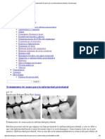 Tratamientos de Ozono para La Enfermedad Periodontal - Ozonoterapias