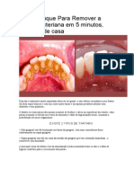 Veja o Truque para Remover A Placa Bacteriana em 5 Minutos