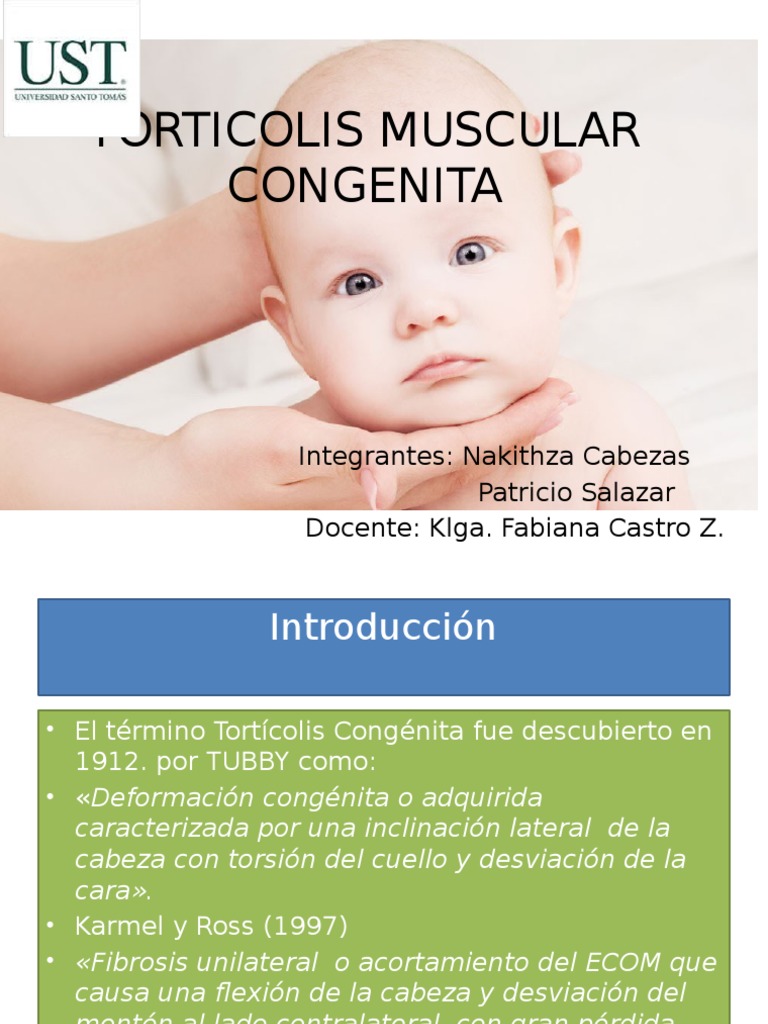 Torticolis Congenita Pdf Medicina Especialidades Medicas