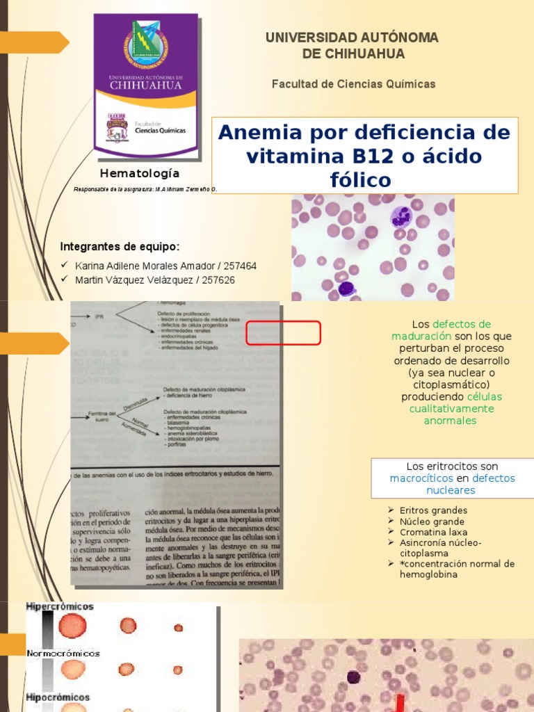Anemia Por Deficiencia de Folatos o Vitamina B12 Ácido fólico