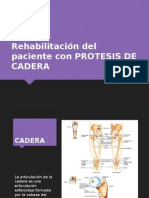 Rehabilitación Del Paciente Con PROTESIS de CADERA