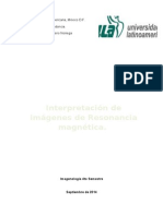 Interpretación de Imágenes de Resonancia Magnética