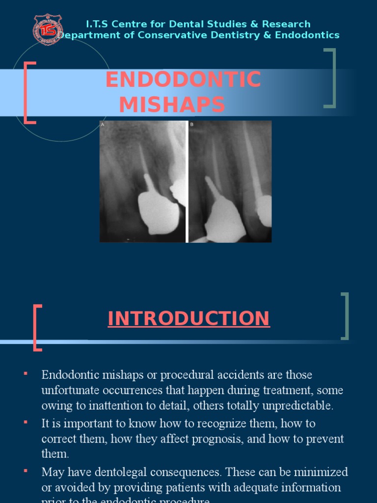 Endodontic Mishaps Medical Specialties Clinical Medicine
